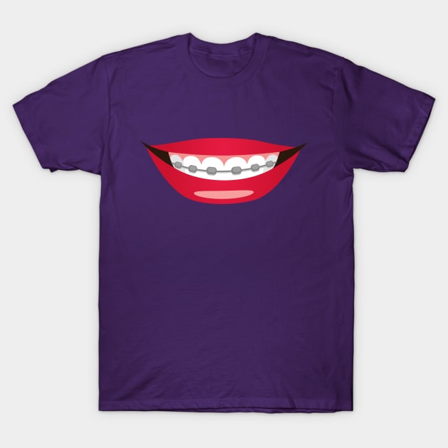 Braces Smiles T-Shirt by DesignbyDarryl